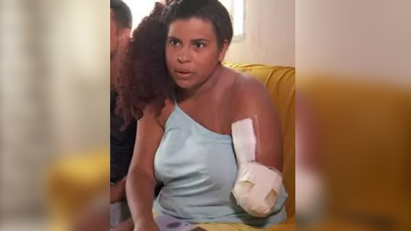 Adolescente que perdeu braço em ataque de tubarão relembra episódio (Reprodução/TV Globo)